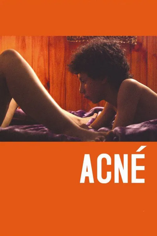 Acné постер