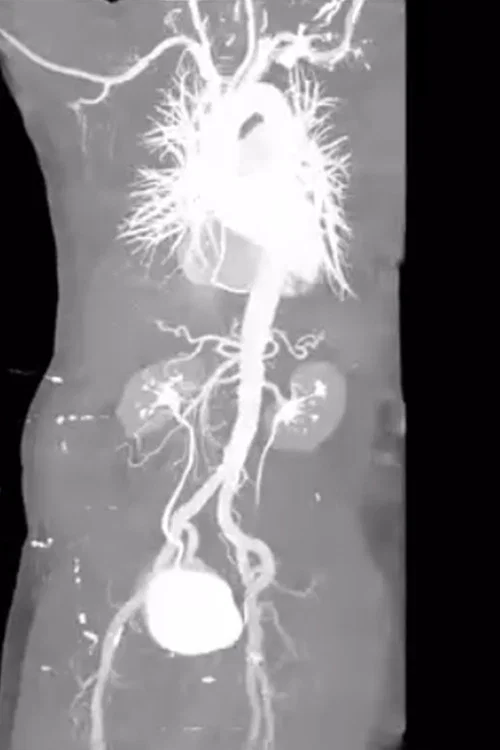 X-Ray Eros постер