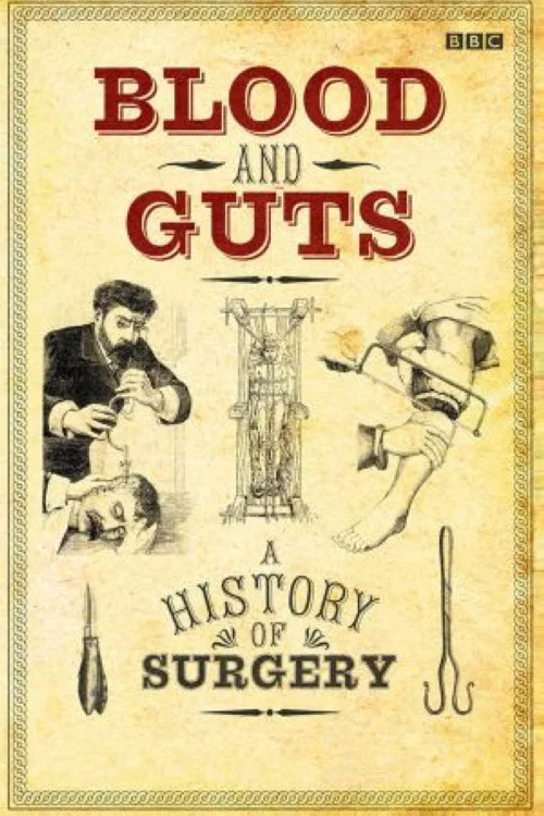Blood and Guts: A History of Surgery постер