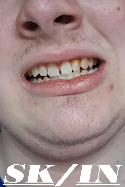 Skin постер