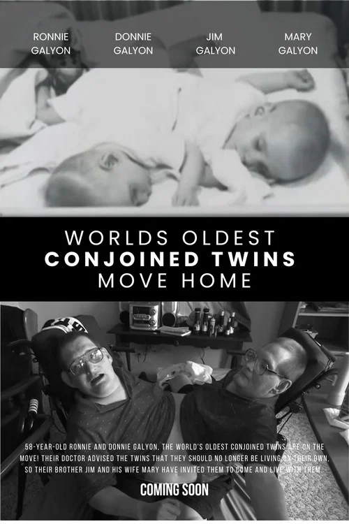 World's Oldest Conjoined Twins Move Home постер