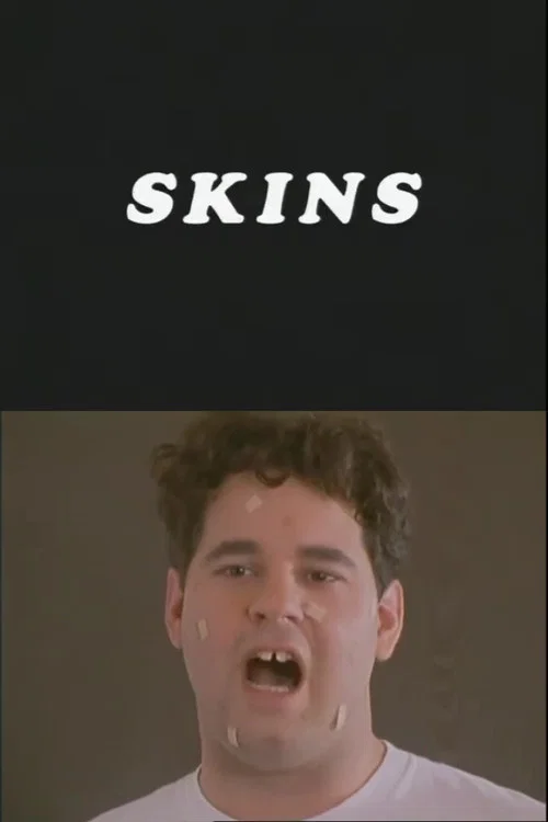 Skins постер