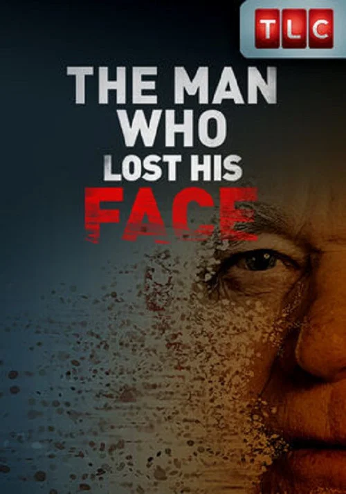 The Man Who Lost His Face постер