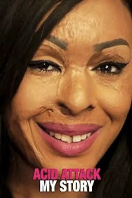 Acid Attack: My Story постер