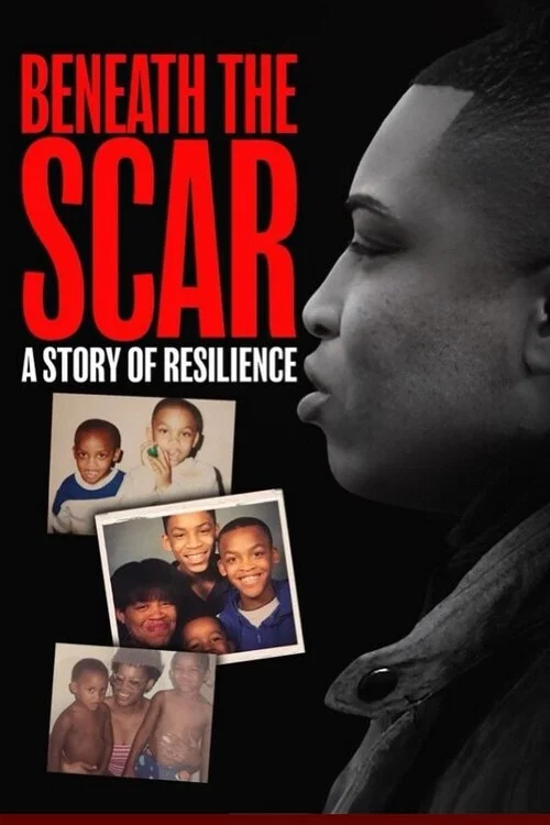 Beneath the Scar: A Story of Resilience постер