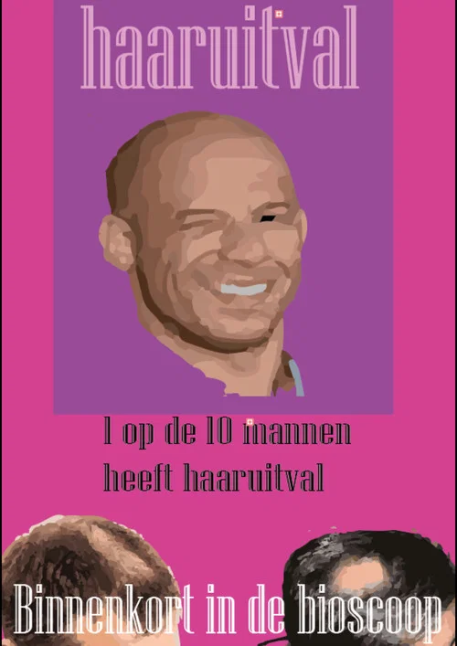 Kaal worden. Wat kan ik doen? постер